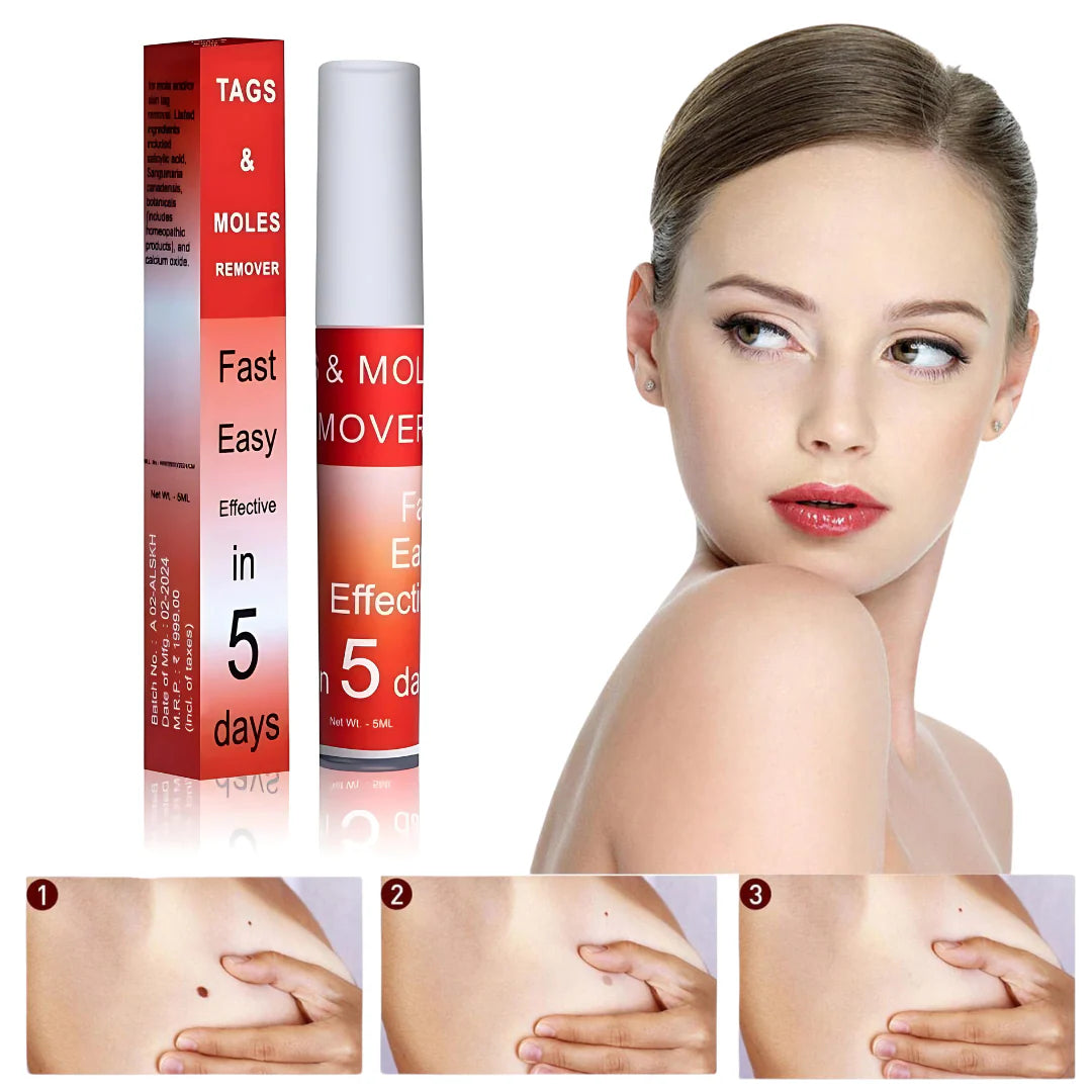 Tags & Moles Remover (Buy 1 Get 1 Free - Pack of 2)