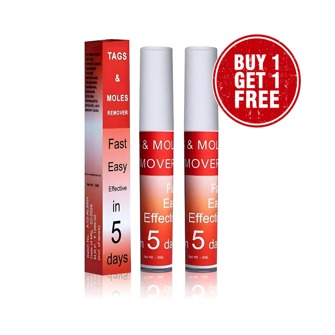 Tags & Moles Remover (Buy 1 Get 1 Free - Pack of 2)