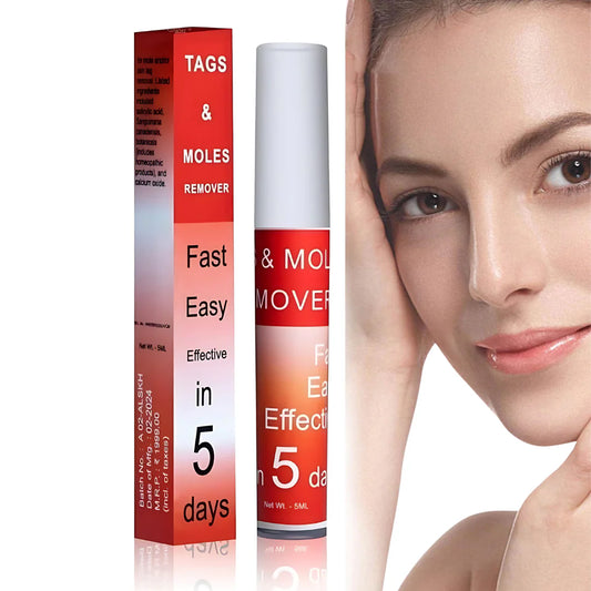 Tags & Moles Remover (Buy 1 Get 1 Free - Pack of 2)
